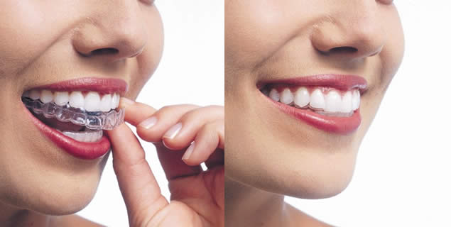 dental treatments