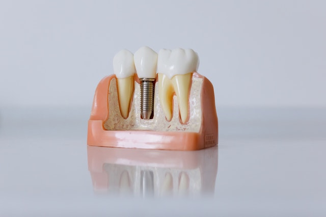dental services wagga wagga