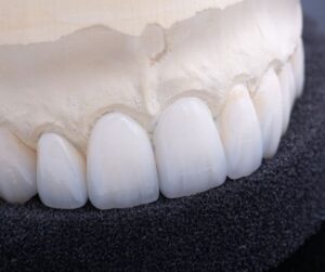 dental crown wagga wagga