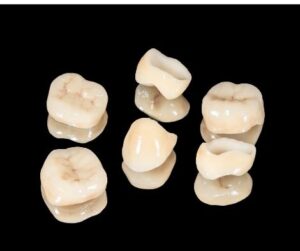 tooth caps