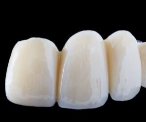 tooth caps