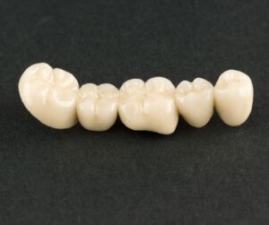 tooth caps
