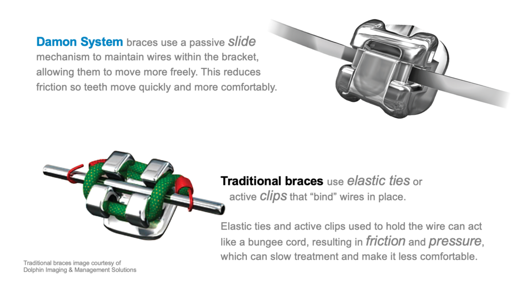 orthodontics