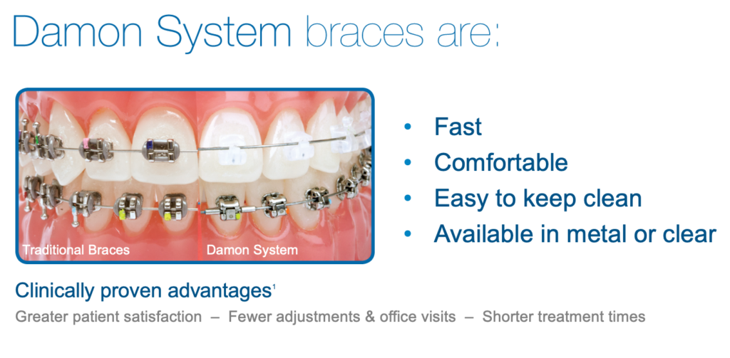 braces wagga wagga