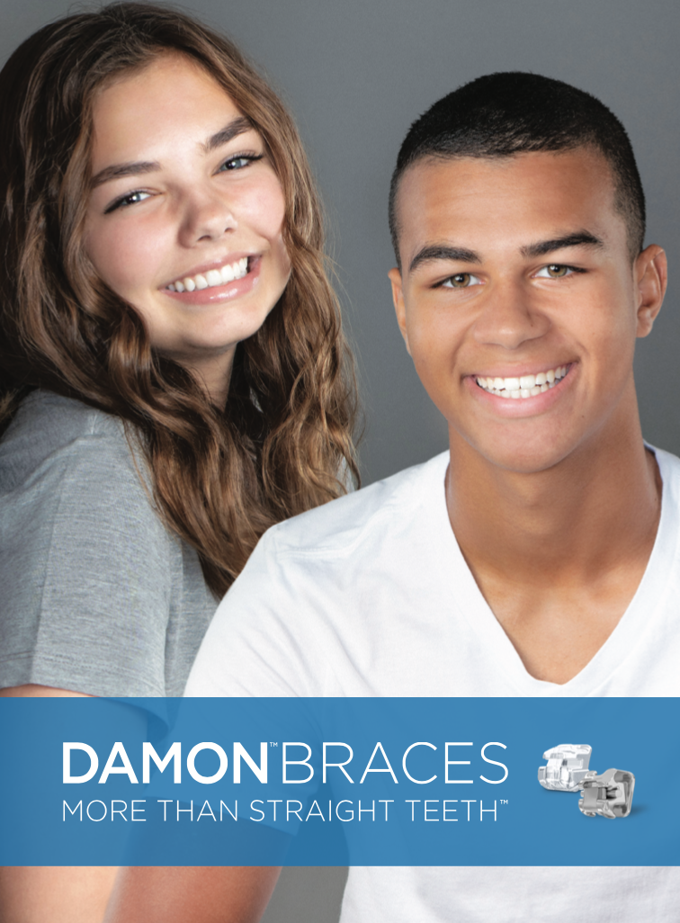 braces wagga wagga