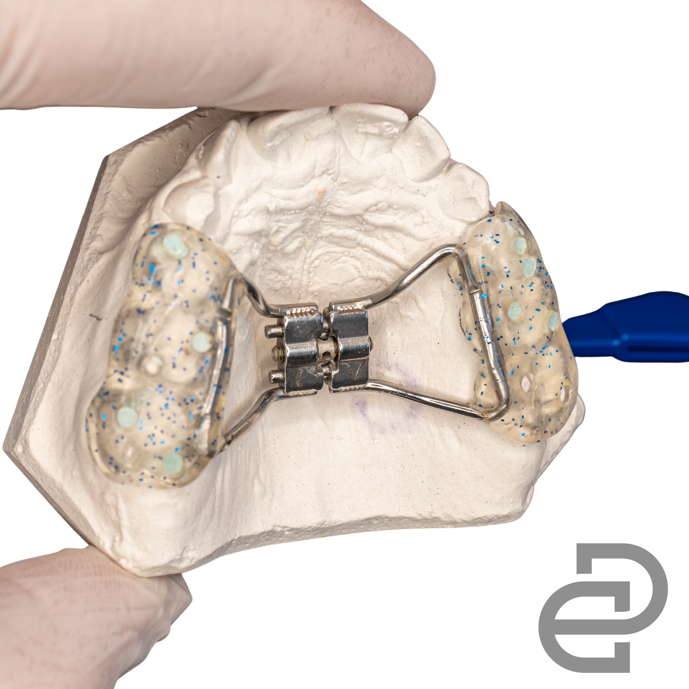 Palatal Expander